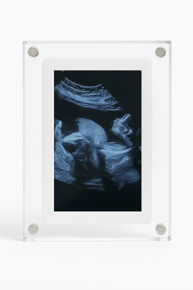 Baby Frame