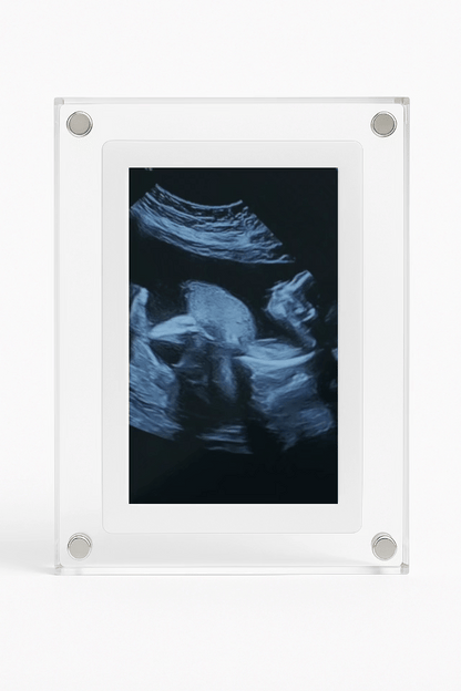 Baby Frame