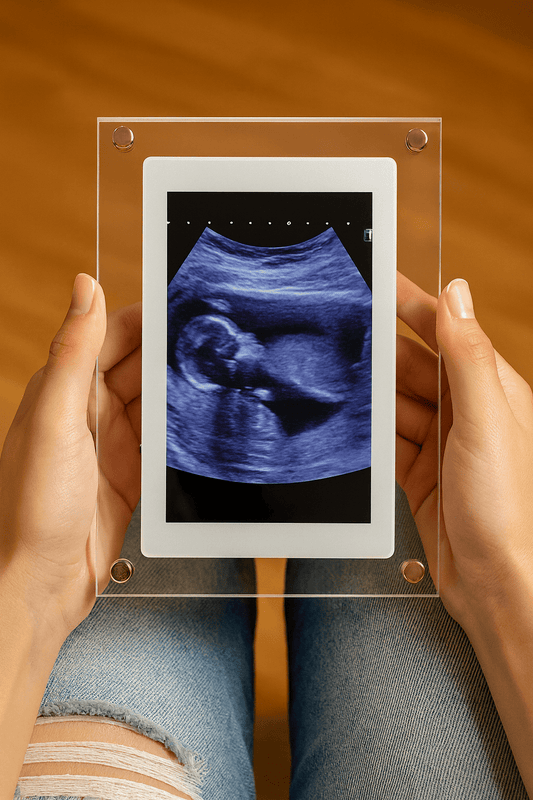 Baby Frame